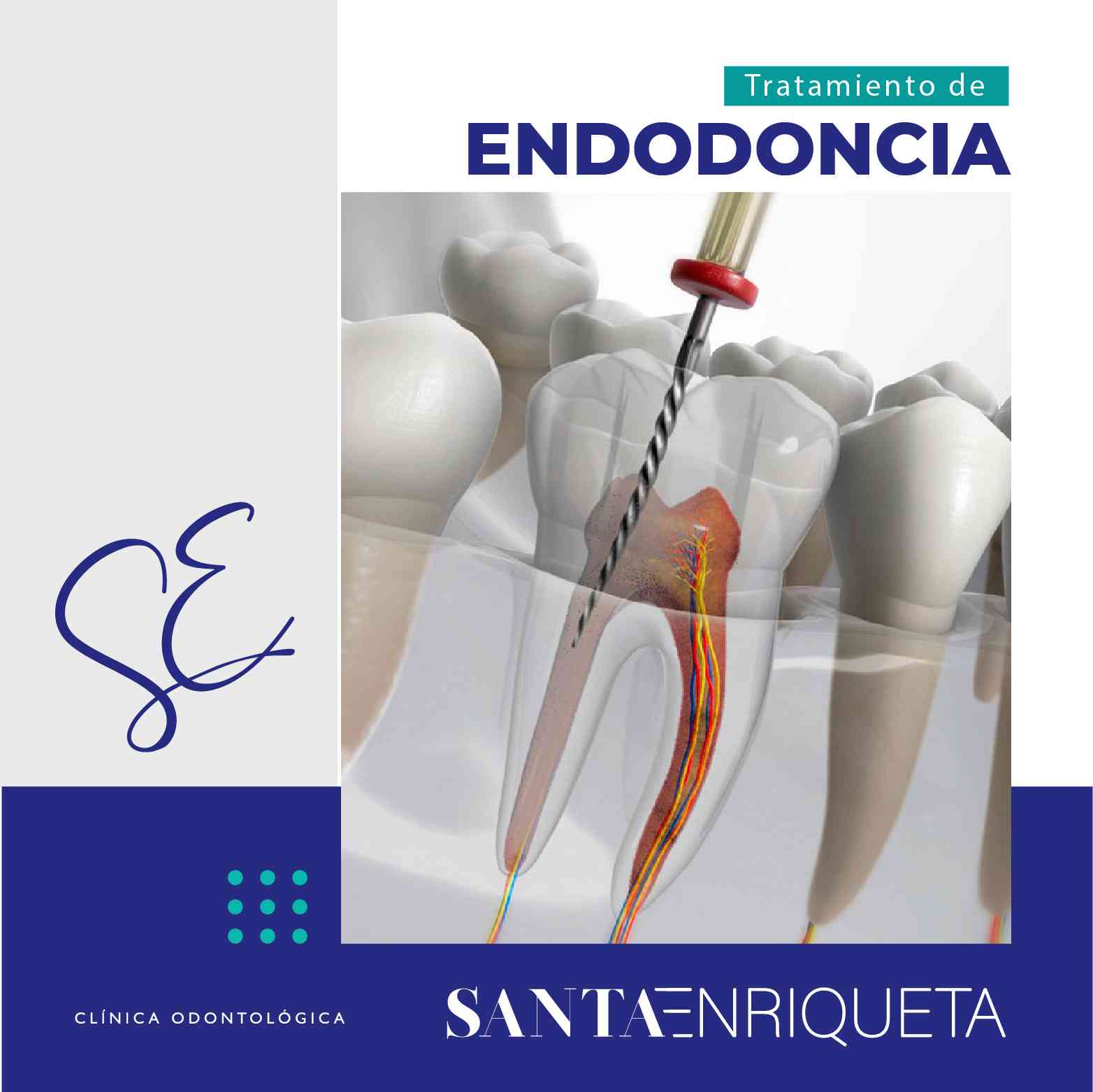 Endodoncia