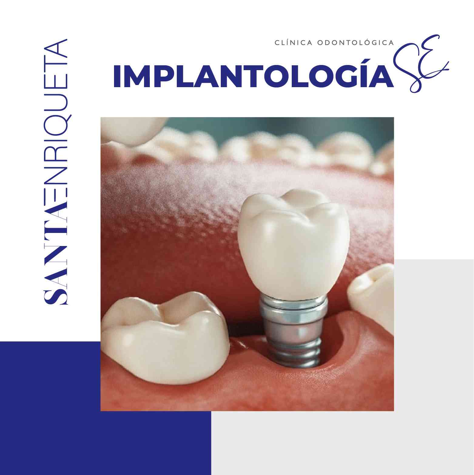 Implantología