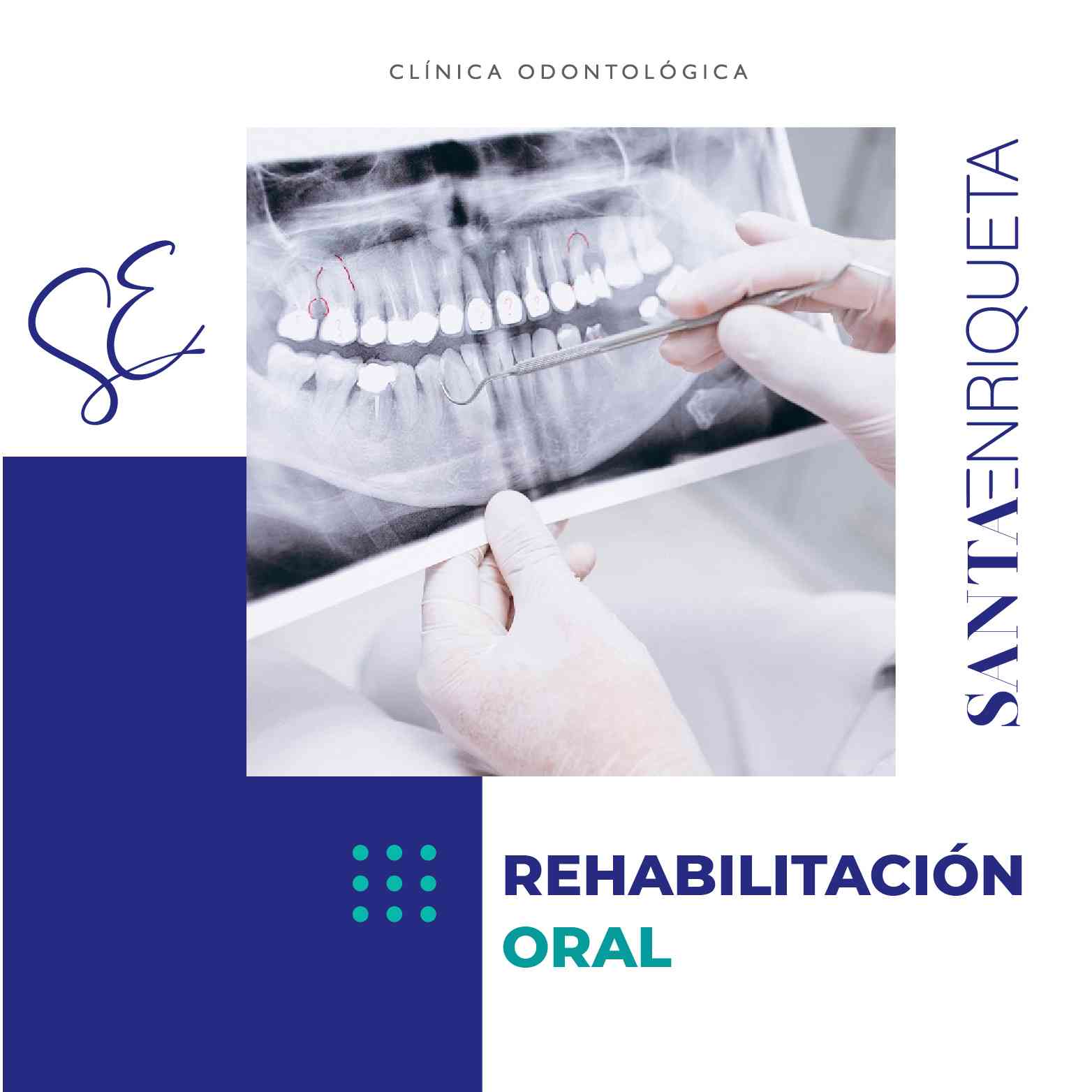 Rehabilitación Oral