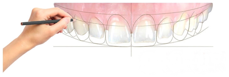 Diseño de Sonrisa